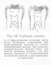 Formarea primei clase de cavități, stomatologie protetice