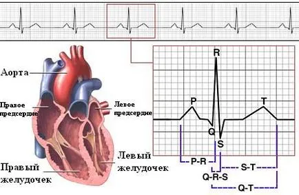 Echokardiográfia szívinfarktus - szív kezelésére
