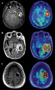 Снимки, снимки на мозъка MRI, рамото, глезена, коляното секции, на шийката на матката,