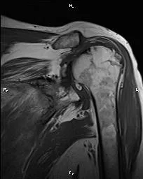 Fotografii, imagini ale creierului IRM, umar, glezna, genunchi secțiuni, cervical,