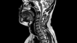 Снимки, снимки на мозъка MRI, рамото, глезена, коляното секции, на шийката на матката,