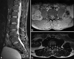 Снимки, снимки на мозъка MRI, рамото, глезена, коляното секции, на шийката на матката,