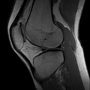 Снимки, снимки на мозъка MRI, рамото, глезена, коляното секции, на шийката на матката,