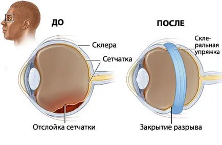 Homeopatia în bolile de ochi