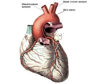 Hypoplasiája aorta típusú, a tünetek és a kezelés a betegség