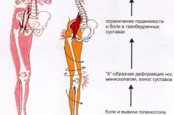 Hogyan kell csinálni masszázs lúdtalp