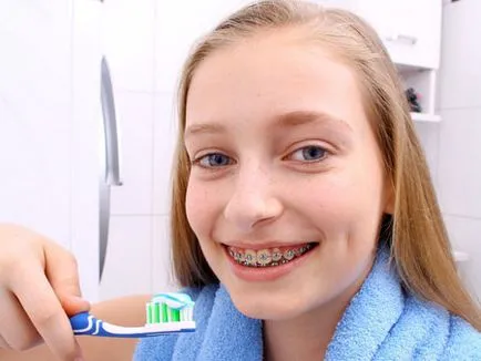 Hogyan fogmosás fogszabályozó
