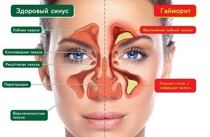 Какво сополи в снимките на синусите и цветни