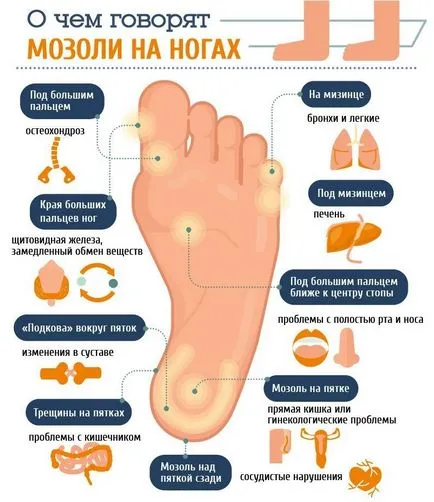Как да премахнете мазоли и мазоли по краката и ноктите на краката