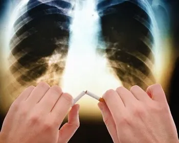 Пушенето и рак, преглед на рак, причинени от тютюнопушенето