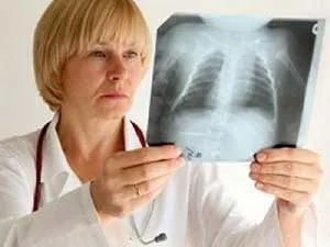 Bronchitis kezelése Izrael klinikák és gyakorlatok