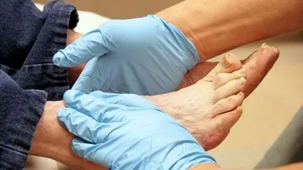 лечение на краката при диабет използването на крем и унгвент за, масаж фута