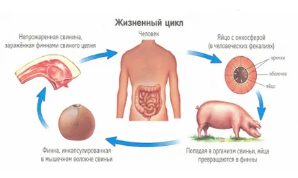 Глисти симптоми и лечение