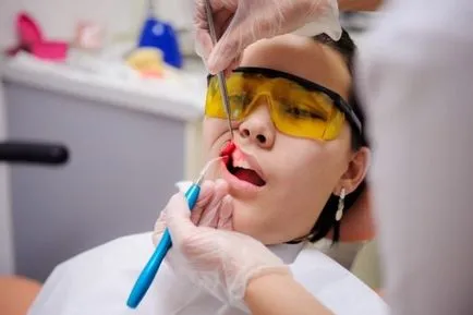 Tratamentul dinților și gingiilor cu laser