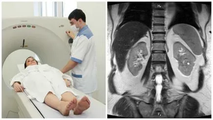 MRI a retroperitoneum, amely bemutatja a felkészülés az eljárás