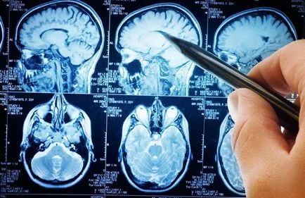 RMN-ul cu îmbunătățirea contrastului a creierului la Moscova, cât de mult contrast IRM, cel mai bun pret