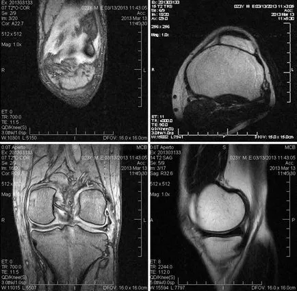 MRI a térd Moszkvában, ahol ezt a címet és az árengedmények, az óra 24