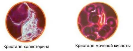 Изследване на тялото от капка кръв