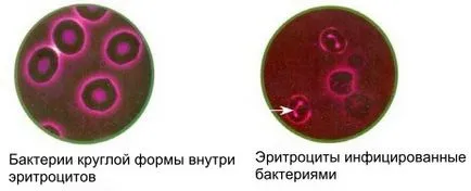 Examinarea corpului de picătura de sânge