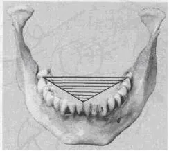 Ocluzale suprafata - stomatologie, gnathology - chirurgie si tratament