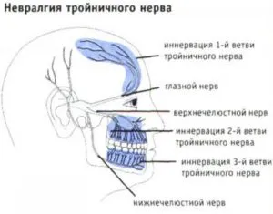 Amorteala buzelor și bărbie nu merge după îndepărtarea molarilor de minte