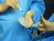elutasítása implantátumok