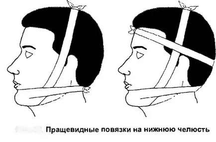 Счупване на долната челюст - как да се намали ефекта от