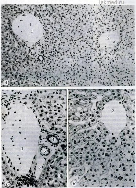 Ficatul - sistemul organismului (histologia)