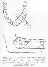 radiografie dentară, stomatologie terapeutică