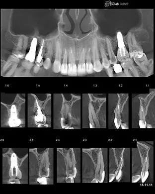 Asigurați-CBCT, con-fascicul de tomografie computerizata 3D, pret