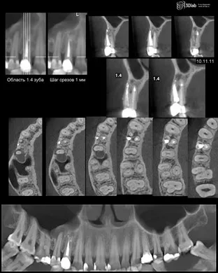 Asigurați-CBCT, con-fascicul de tomografie computerizata 3D, pret