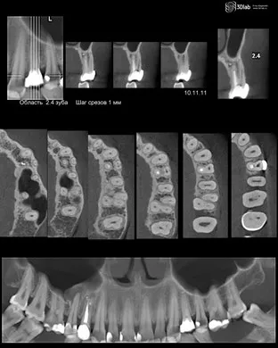 Asigurați-CBCT, con-fascicul de tomografie computerizata 3D, pret