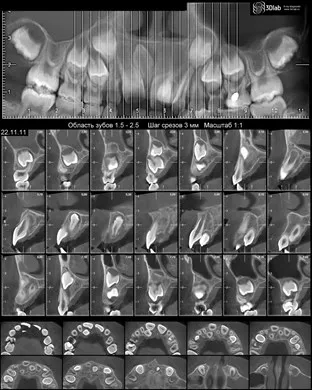 Tedd CBCT, kúp nyaláb komputertomográfiás 3d, ár