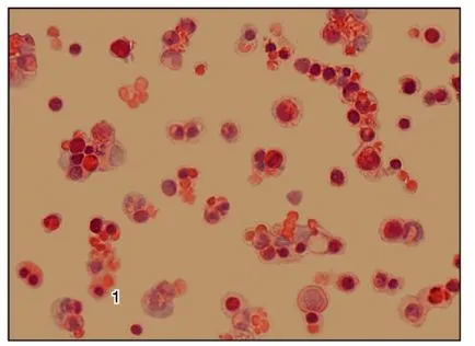 Sistemul de corpuri de hematopoiezei și a apărării imune