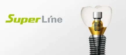 SuperLine импланти преглед директория, ползи, монтаж, експлоатационен живот