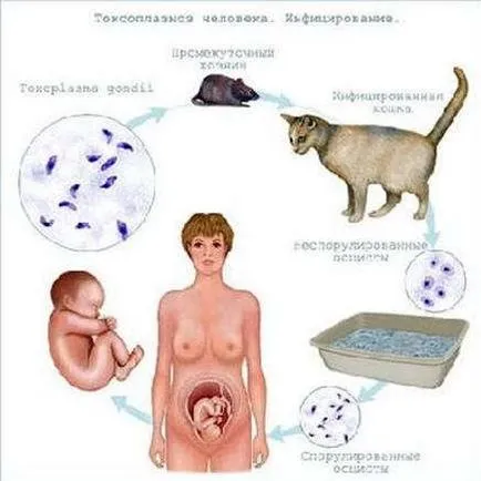 simptome toxoplasmoza, diagnostic, tratament