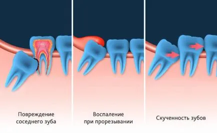 Мъдрец отстранен - ​​колко ще излекува отговора тук!