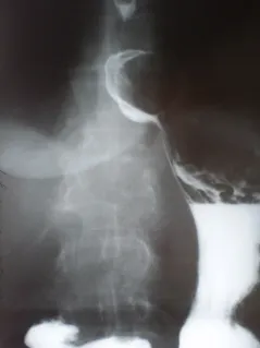 В историята на травма, рентгенолози портал