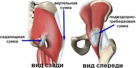 Trochanteric бурсит на симптомите на бедрото и медикаменти