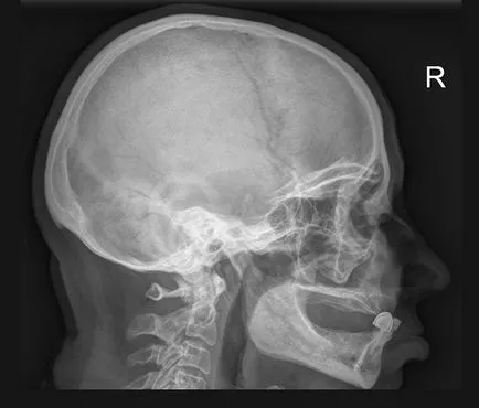 Mi az X-ray, a fej, a fajtáit és jelzések