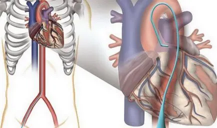 10 kevéssé ismert tény az emberi szív mindenkinek, aki törődik az egészségügy