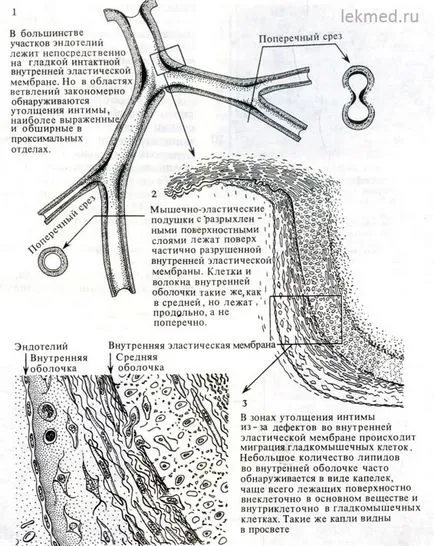 Arterele si arteriolele - sisteme ale corpului (histologie)