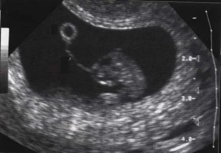 Terhesség és szülés Mi SVD Terhesség portál - tippek a nők és a lányok