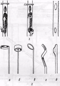 Embolectomia és thrombectomia - módon dezobliteratsii hajók - az aorta és a nagy műtét