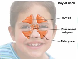 Ethmoiditis - mint lehet