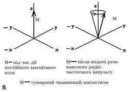 baze fizice de imagistica prin rezonanta magnetica (IRM)