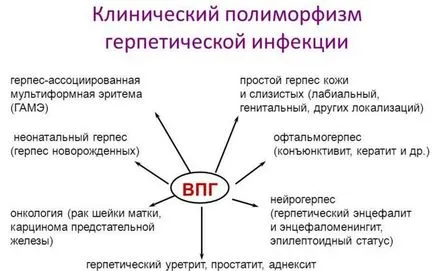 Херпесен кератит причини, симптоми, лечение