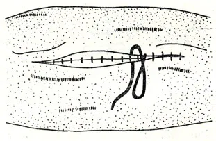 Corpuri străine în stomac și intestine (Aliena corpora) 1958 - de câini (non-contagioase)