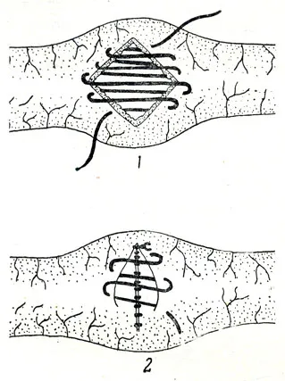 Corpuri străine în stomac și intestine (Aliena corpora) 1958 - de câini (non-contagioase)