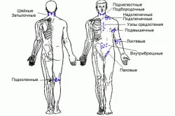 Care Ganglionii limfatici sunt crescute in HIV